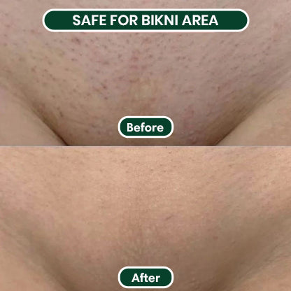 2 in 1 Woman Body Shaver